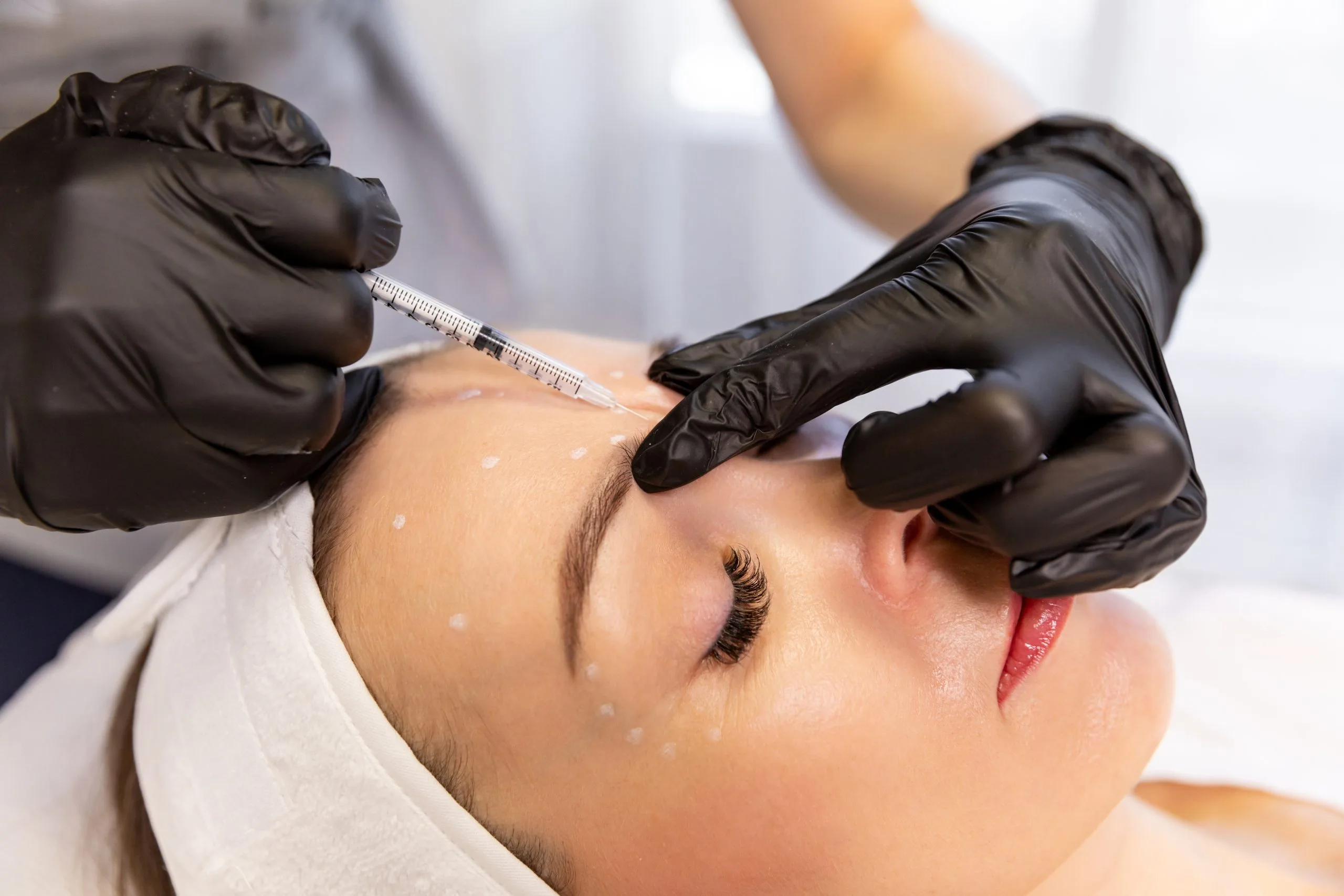 How Long Does Botox Last? A Complete Guide to Duration and Results banner